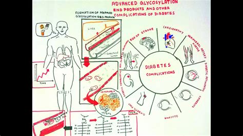 Advanced glycation endproduct advanced glycation endproducts (ages) are the result of a chain of chemical reactions after an initial glycation reaction. Advanced Glycosylation End Products and Diabeteic ...