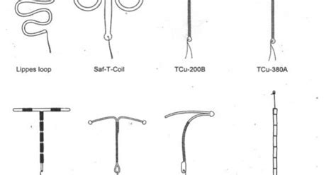 Iudspiralalat Kontrasepsi Dalam Rahim Akdr