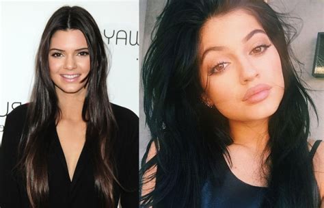 Kendall Jenner Lip Injection Plastic Surgery Before And After Lips