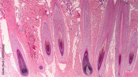 Photomicrograph Of Cross Section Human Scalp Showing Histology Of Hair