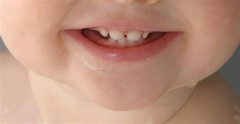 Teeth Development In Children Central Coast Orthodontics