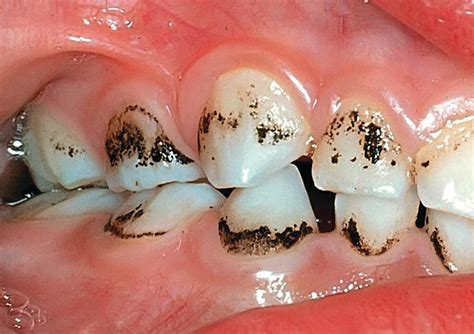 14 Periodontal Conditions Pocket Dentistry