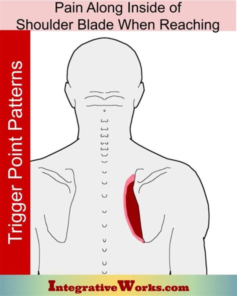 Pain Between Shoulder Blades Pain Patterns Causes Self Care