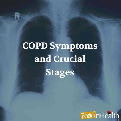 What Are The Copd Symptoms And Crucial Stages Food N Health