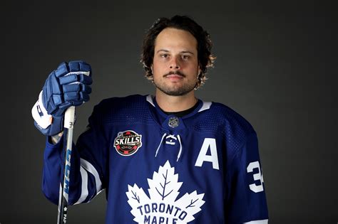 Maple Leafs Auston Matthews Teeth Before And After Long Hair Suits His