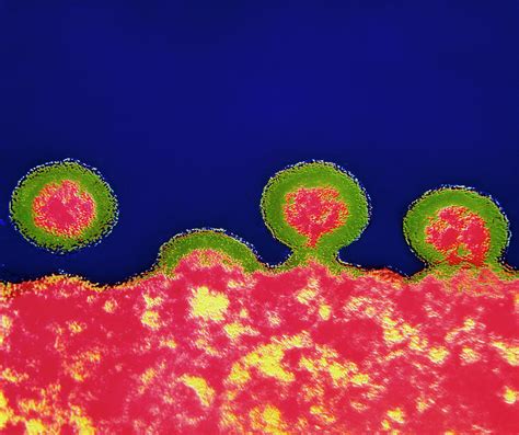 Coloured Tem Of Hiv Viruses Budding From A T Cell Photograph By Nibsc