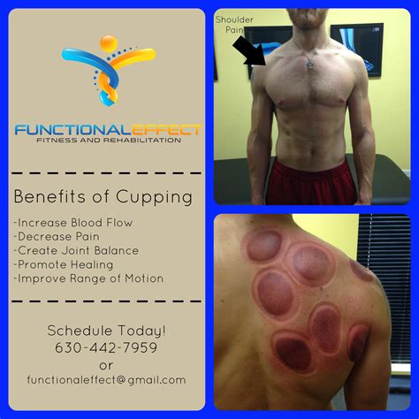 Cuppingyeah It Really Works And Heres Why › Functional Effect