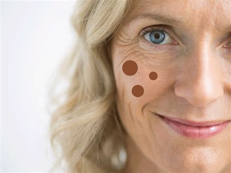 10 Dark Spot Correctors That Will Rid Your Skin Of Age Spots And