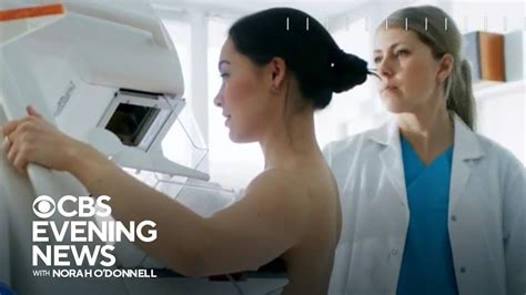 New Mammogram Guidelines Say Screenings Should Start At 40 Youtube