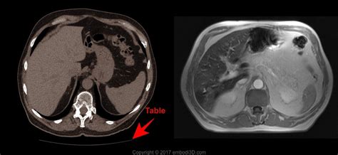 So You Can Easily Distinguish The Difference Between MRI And CT Scan 2023