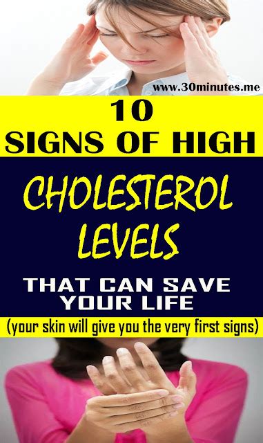 10 Symptoms Of High Cholesterol That You Shouldnt Ignore Health And