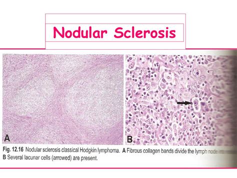Ppt Lymph Node Histology Powerpoint Presentation Free Download Id
