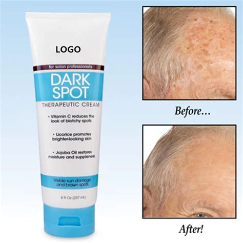 Best Dark Spot Wrinkle Remover Cream For Face And Body Buy Dark Spot