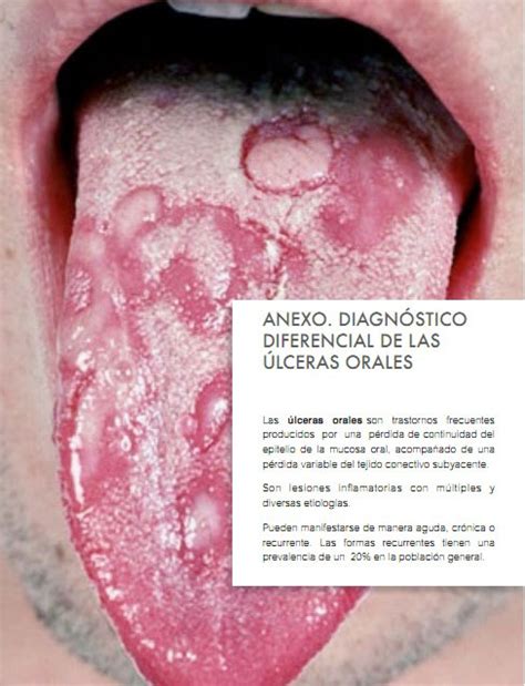 Odontocat Curso Online De Manifestaciones Orales De Las Enfermedades