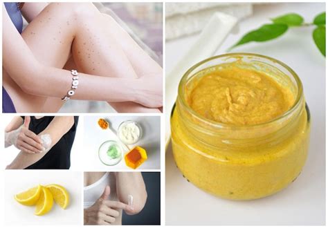 6 Natural Ways To Remove Dark Spots From Arms And Legs