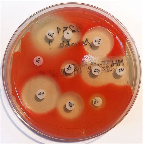 The addition of starch to mueller hinton agar ensures that toxic factors found during growth will be absorbed, and its presence is often essential to establish growth from very. Serratia marcescens | Microbiology, Agar art, Bacteria