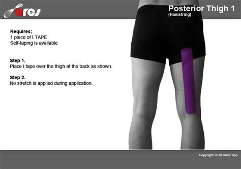 Posteriorthigh Kinesiologytapingforthigh Painrelief It Band Syndrome