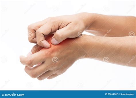 People Scratch The Itch With Hand Stock Photo Image Of Dermatology