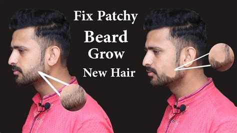 naturally fast fix patchy beard at home fix patchy and growth beard new hair naturally youtube