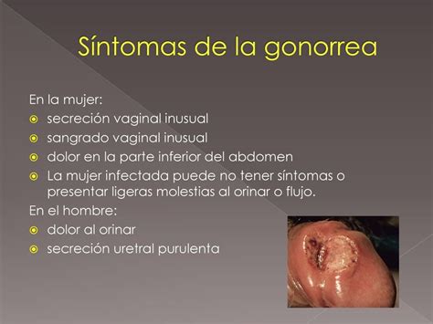Los Sintomas De La Gonorrea