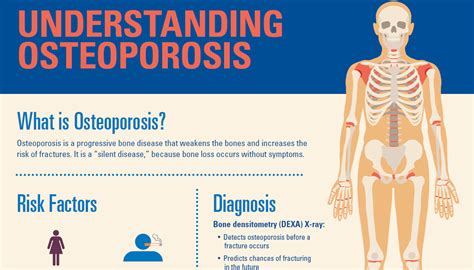 Here's what you need to know about osteoporosis: Health & Lifestyle Tips