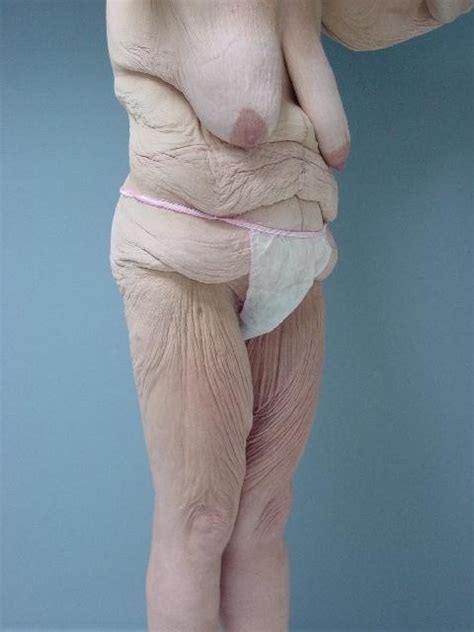 Wrinkled Old Grannies Nude Telegraph
