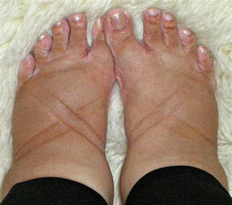 Dehydration is another reason you may feel bloated while flying. These Feet Weren't Made For Walking : The Baby Project : NPR