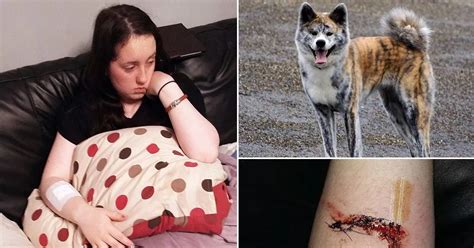 Selfless Dog Attack Victim Pleads To Save Japanese Akita That Ripped
