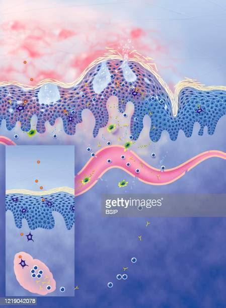 Erythematous Photos And Premium High Res Pictures Getty Images