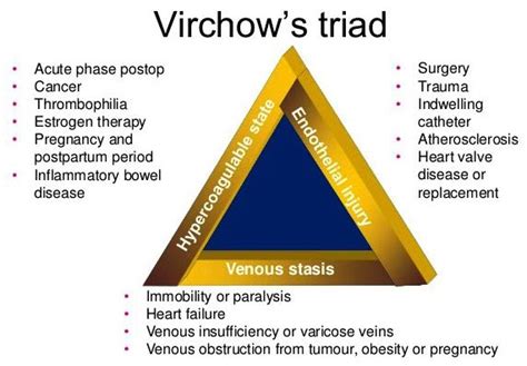 Studying Medicine On Twitter Virchows Triad 3 Factors That May