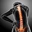 Spinal Cord Compression/Injury Top Spine Surgeon Manhattan