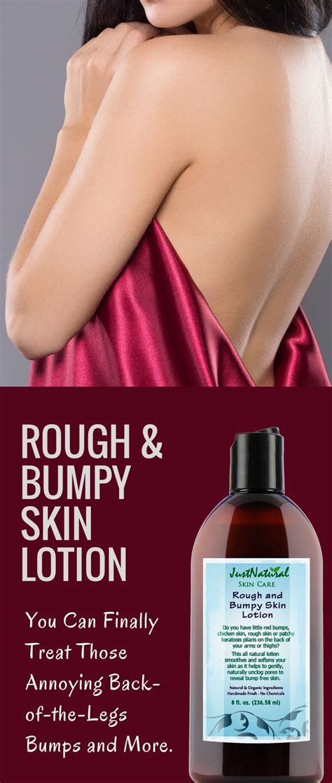 Rough And Bumpy Skin Lotion You Can Finally Treat Those Annoying Back