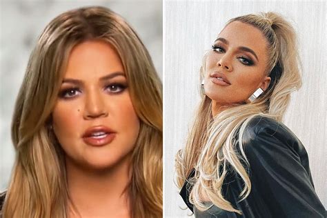 kardashian fans praise khloe for finally being so honest about getting plastic surgery in