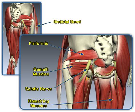 It can contribute to pain in the low back, hip, buttock, and down the outside of the upper leg. Piriformis Syndrome and Lower Back Pain | Coon Rapids Chiropractic