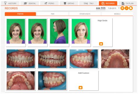 Start Orthodontic Cases In 5 Simple Steps