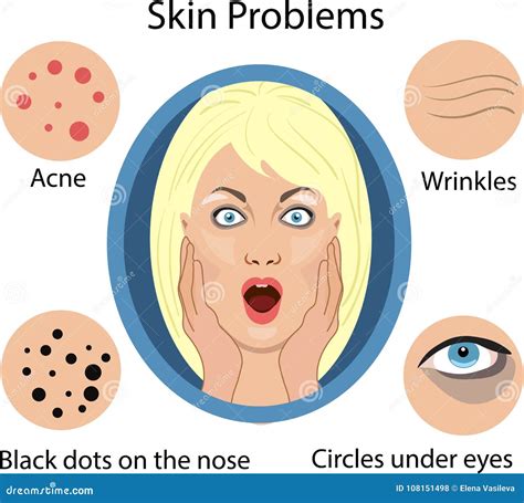 Female Face Skin Problems Vector Illustration For Cosmetic Stock