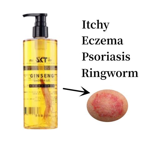 Eczema Body Wash Eczema Treatment Itchy Skin Psoriasis Antifungal