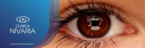 Secreción Ocular ¿qué Es Y Que No Es Normal Clínica Nivaria