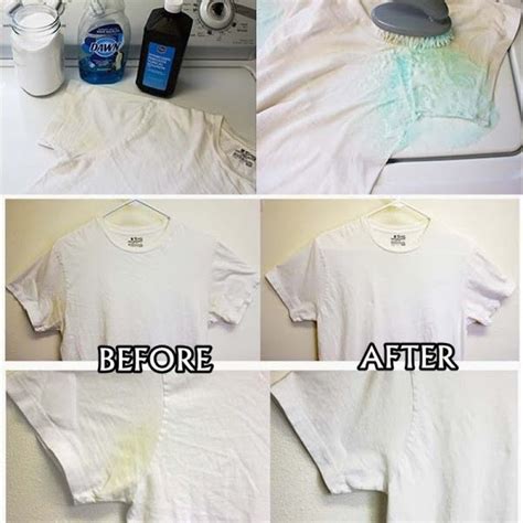 How To Get Rid Of Yellow Armpit Stains Easystufftips Remove Sweat