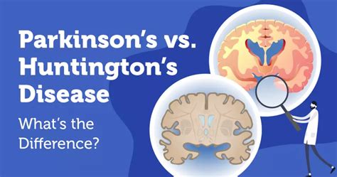Parkinsons Vs Huntingtons Disease Whats The Difference