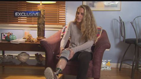 Marathon Bombing Survivors Foundation To Give Woman New Prosthetic Leg Youtube