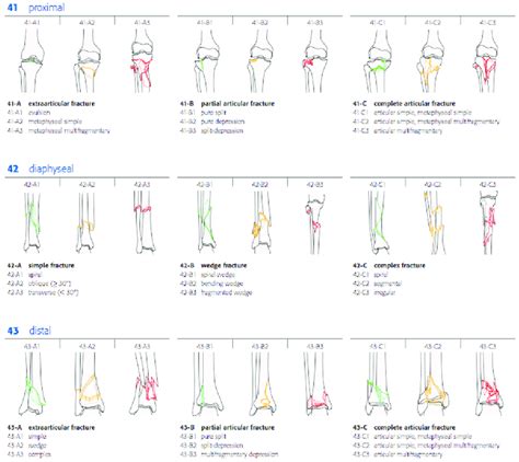 Ao Classification For Tibia Fractures Copyright Ao Foundation
