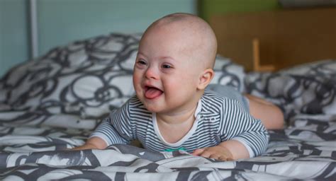 What to say to the parents of a baby with down syndrome: Tummy time - BabyCenter Australia