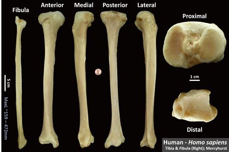 Human Tibia Osteoid Bone Identification