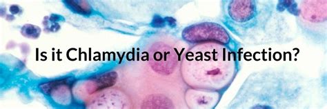 Is It Chlamydia Or Yeast Infection Lets Beat Vaginal Yeast
