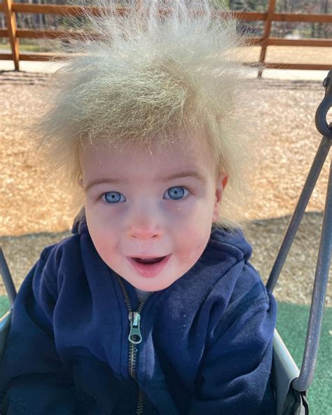 My Son Is One Of 100 Kids With A Rare Syndrome Trolls Mock His
