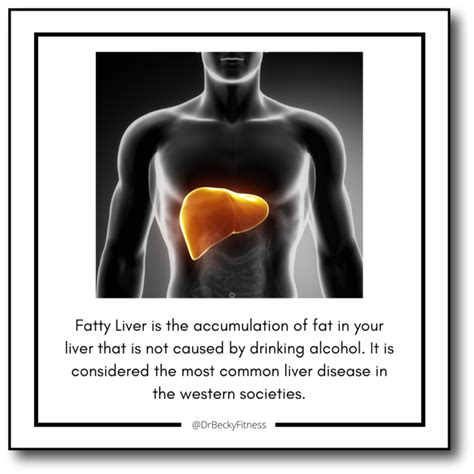 Fatty Liver What Is It Do You Have It How Is It Treated Dr Becky