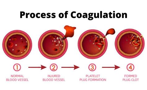 Blood Coagulation Mechanism And Process Pathways