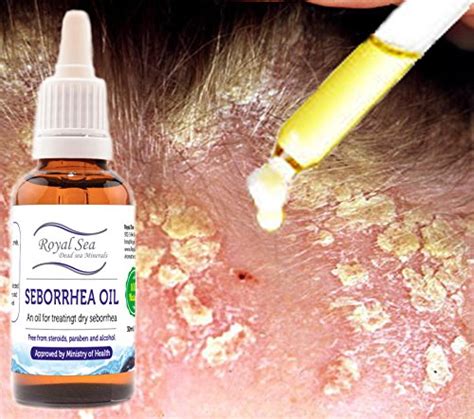 Royal Dead Sea Seborrhea Oil Seborrhoeic Seborrheic Dermatitis Face
