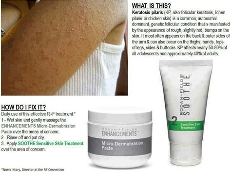 How To Treat And Get Rid Of Keratosis Pilaris Kp Those Little Red